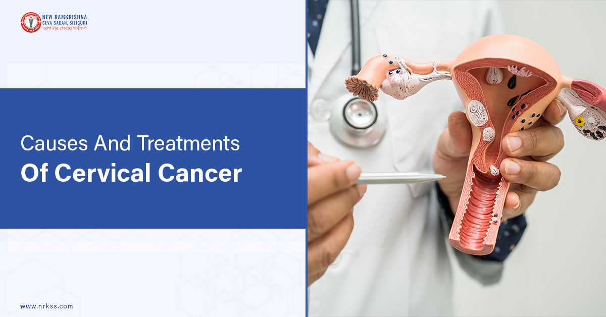 Causes And Treatments Of Cervical Cancer