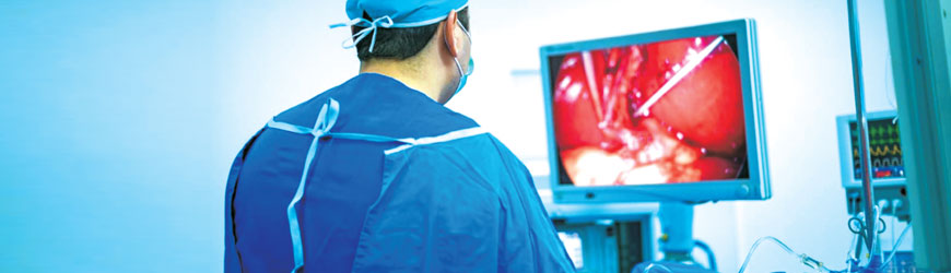 Laparoscopy Surgery