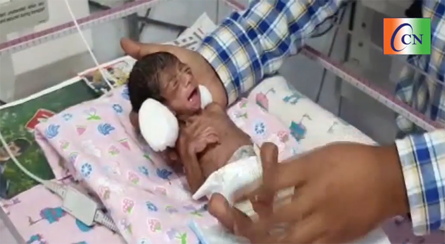 NRKSS gives new life to premature baby